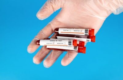 negative std test results pdf 2023
